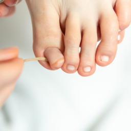 Is Zetaclear Safe For Treating Toenail Fungus While Pregnant